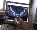 WiiMote Anwendung für die Evaluation eines CT Scans